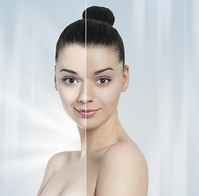 Harmful Chemicals and Skin Whitening Products - Laser Skin 
