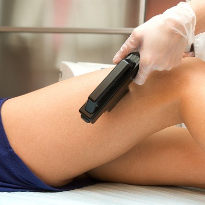 cellulite removal treatment