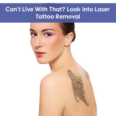 Laser Tattoo Removal in Abu Dhabi